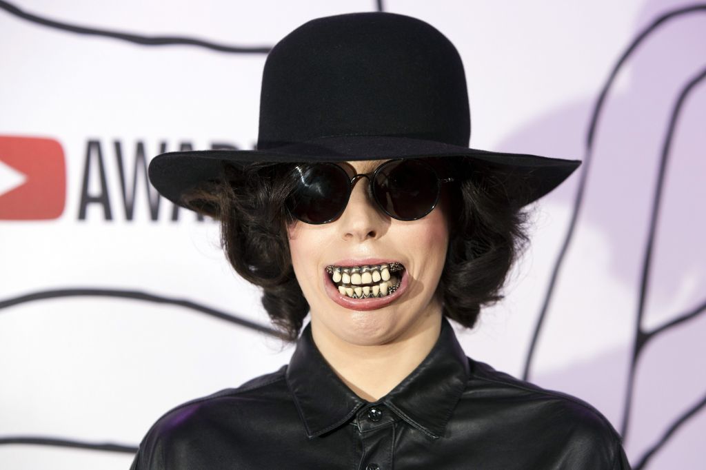 Kaj se je zgodilo z obrazom Lady Gaga?