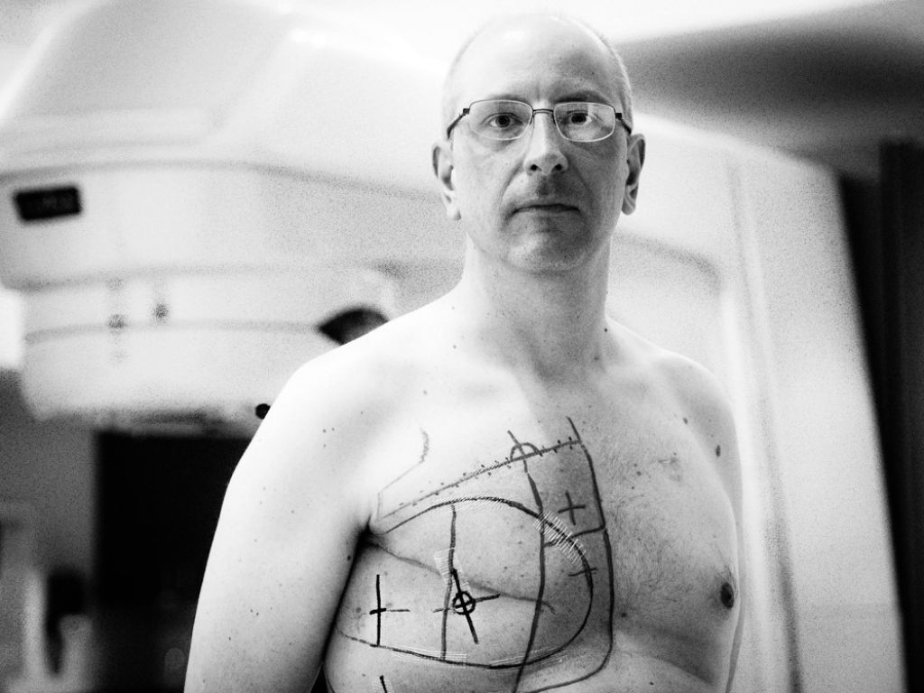 FOTO: Moški, ki so preživeli raka dojke
