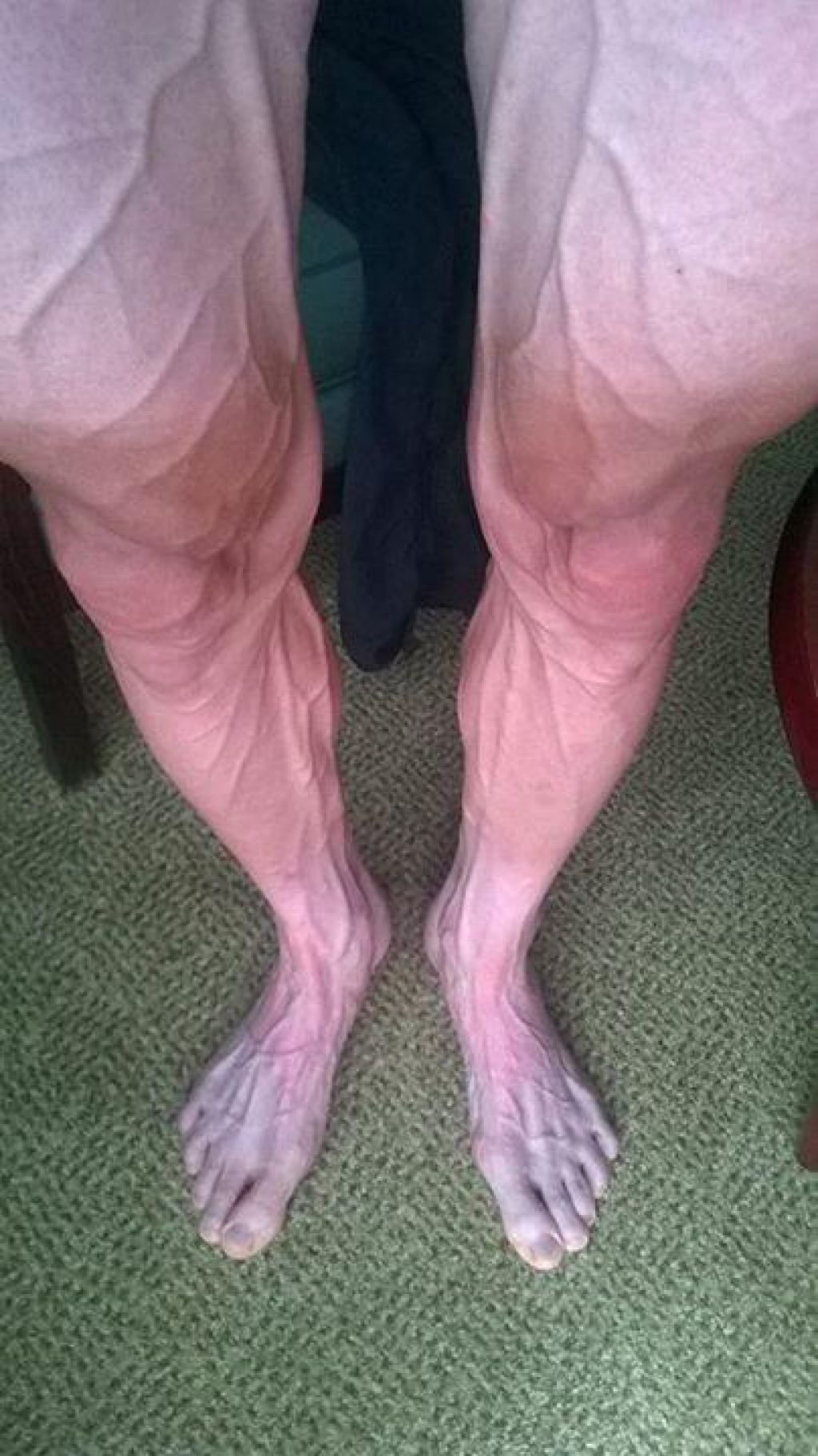 FOTO: To so noge kolesarja po 18. etapi dirke po Franciji