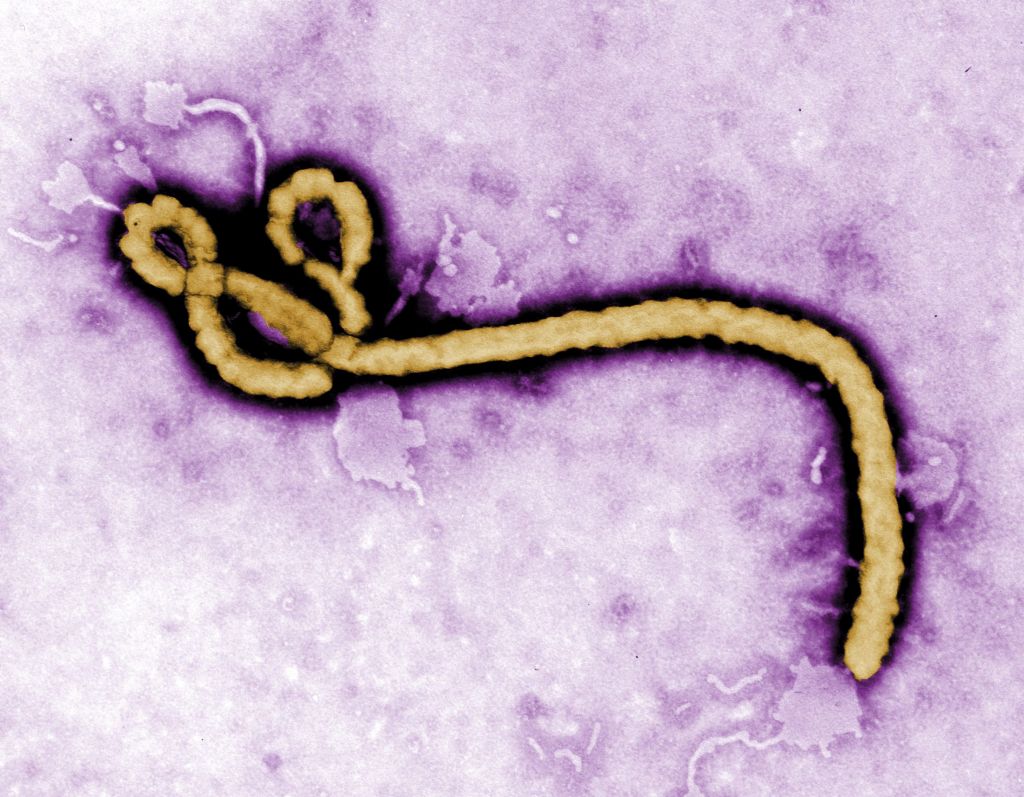 Zdravnik, okužen s smrtonosno ebolo, prispel v ZDA