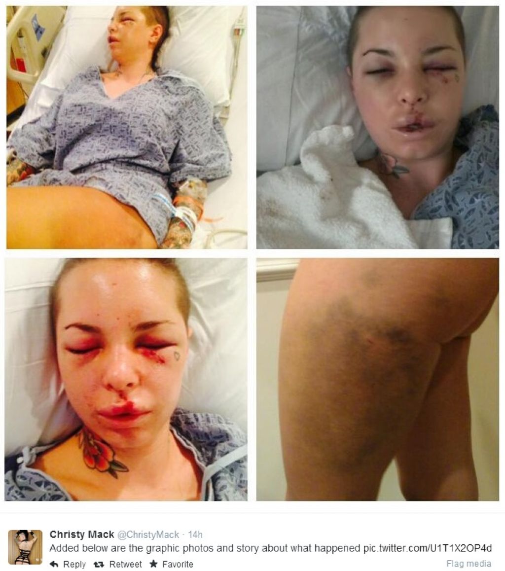 FOTO: Profesionalni borec krvavo obdelal svoje bivše dekle