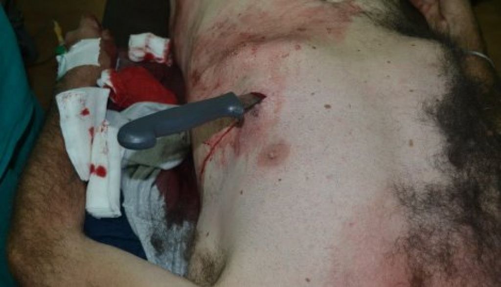 FOTO: Kirurg na facebooku objavil fotografijo spodletelega samomora