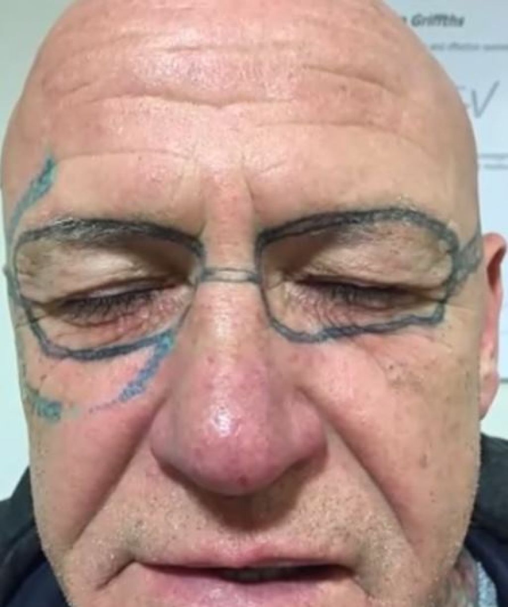 VIDEO: Na fantovščini si je  dal tetovirati očala