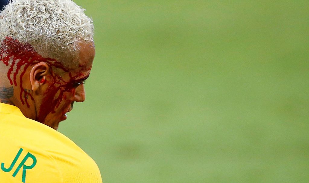 FOTO in VIDEO: Neymar obležal v krvi