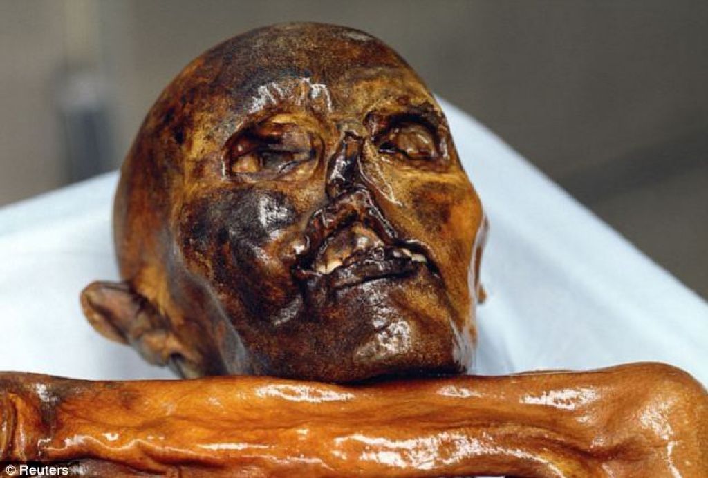 Mumija pri zobozdravniku:  karies in slab zadah