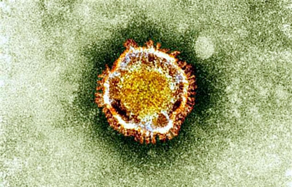 Če virus mutira, je blizu smrtonosna pandemija