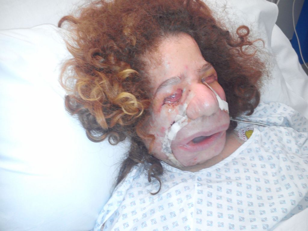 Tina komaj čaka na operacijo v Londonu, ki ji bo dala novi obraz