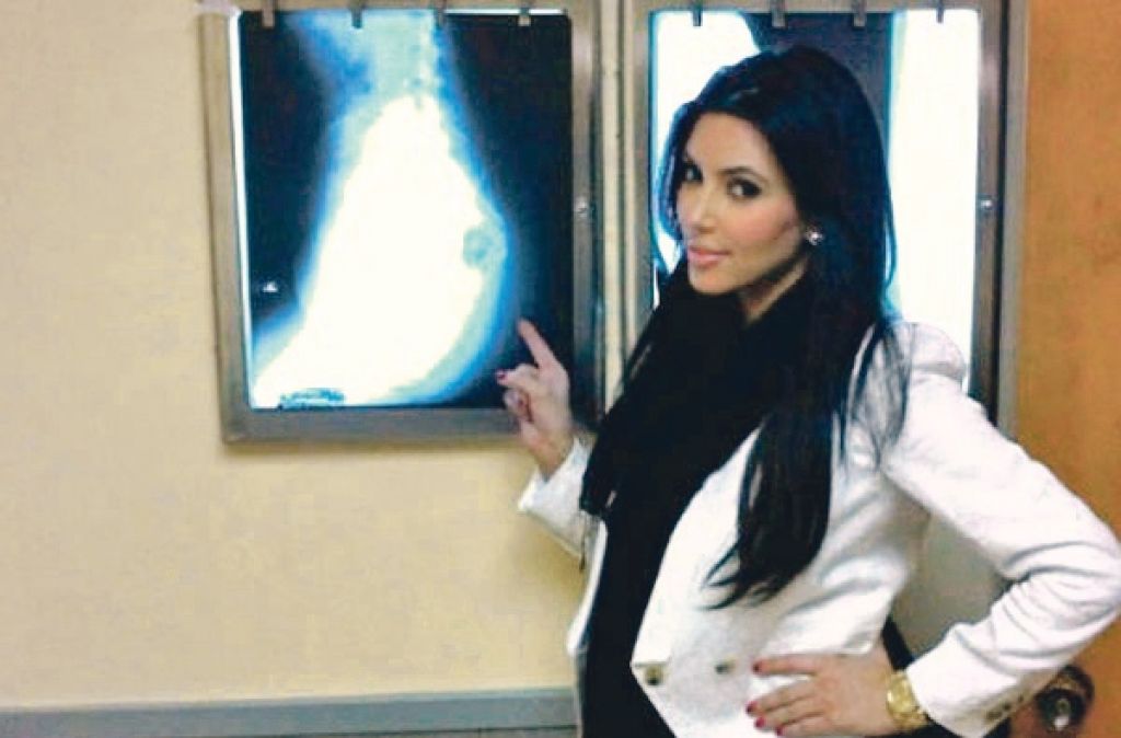 Kim je z rentgenom dokazala,  da je njena ritka prava