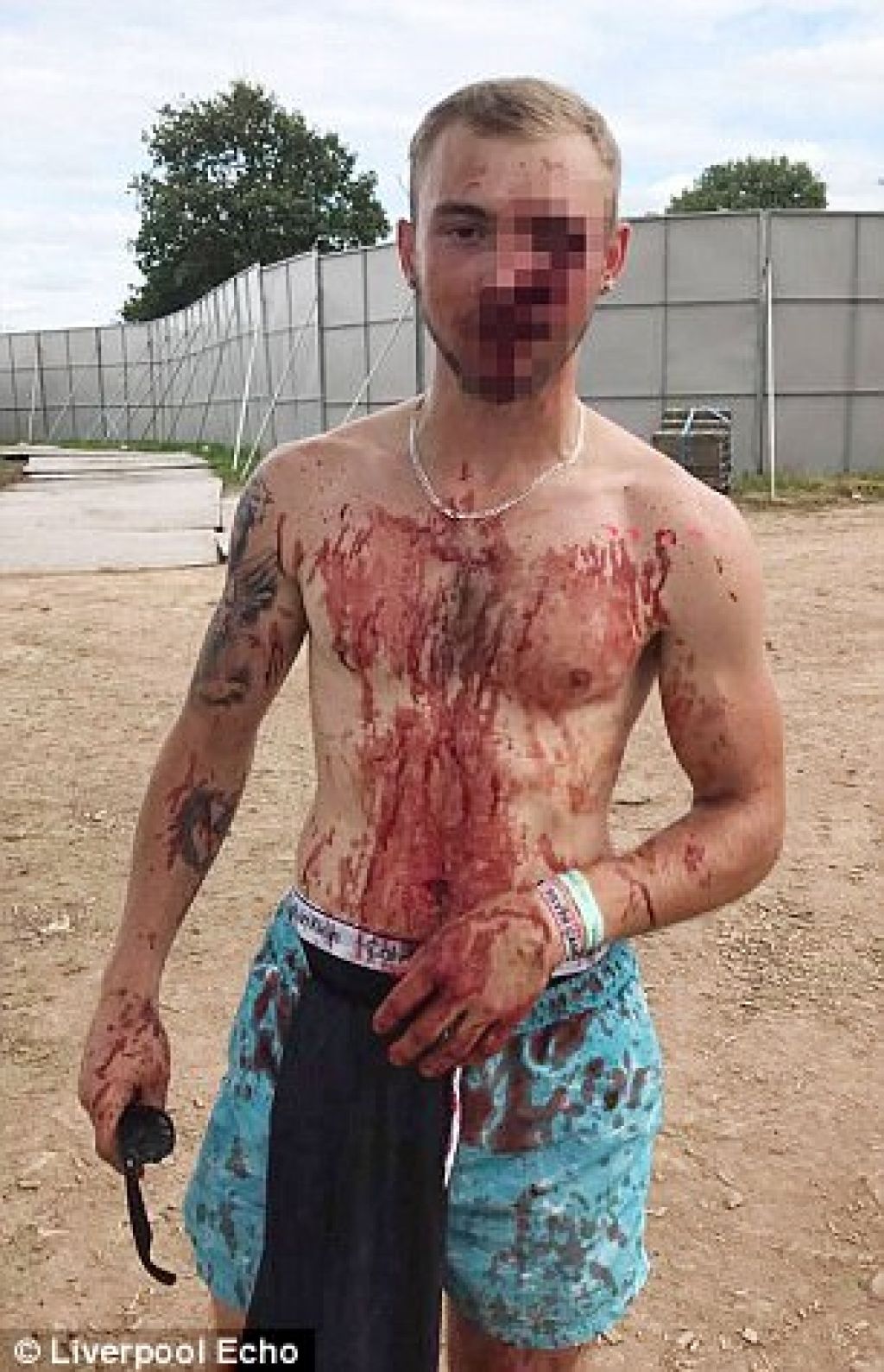 Mladenič (21) se je zbudil v krvi, z zlomljenim nosom in ličnico