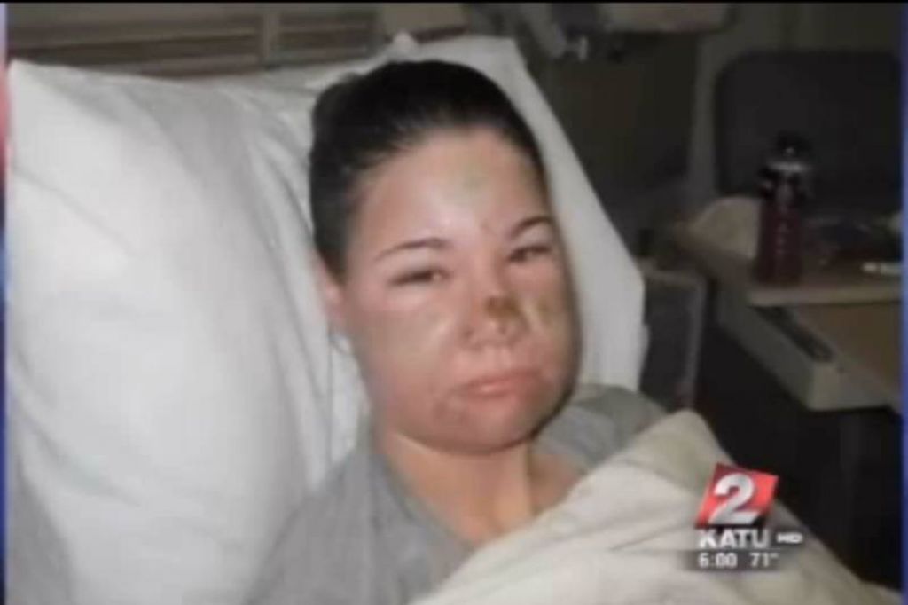 Ženska (41) s kislino napadla štiri mladenke 